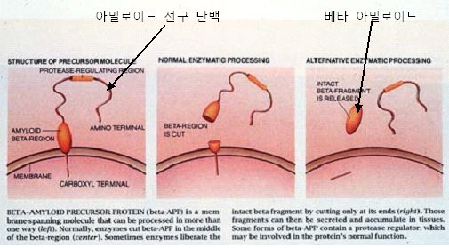 이미지: 베타 아밀로이드