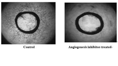 이미지: rat aortic ring assay