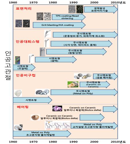 이미지: 인공고관절성장과정