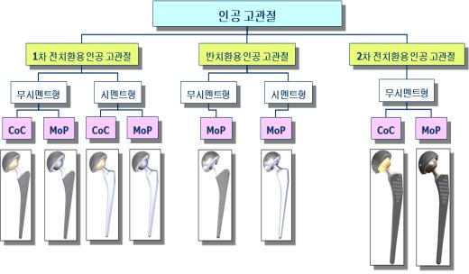 이미지: 코렌텍 인공고관절 제품군