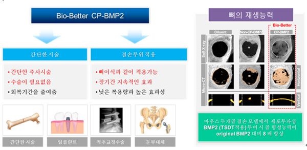 이미지: 골형성 촉진제 소개
