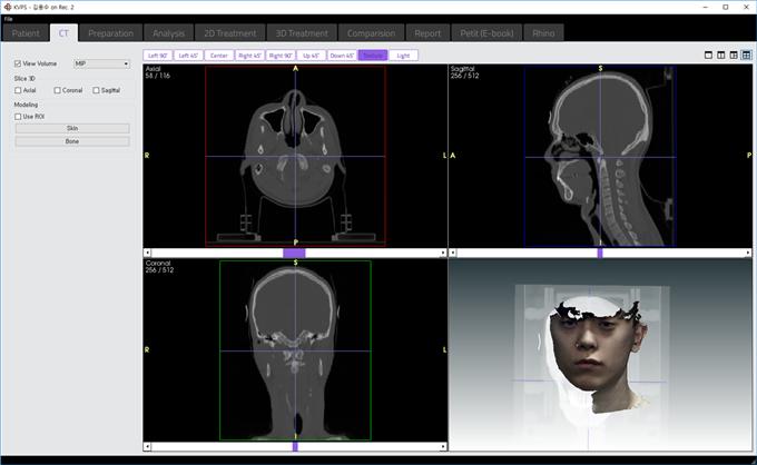 이미지: 25. 3d데이터와 ct데이터 연동