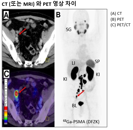 이미지: CT/MRI vs PET