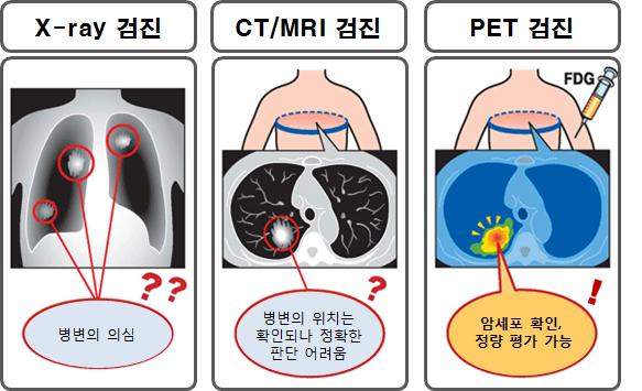 이미지: 영상진단방법 출처: http://www.ncgm.go.jp/sogoannai/housyasen/kakuigaku/ inspect/pet.html