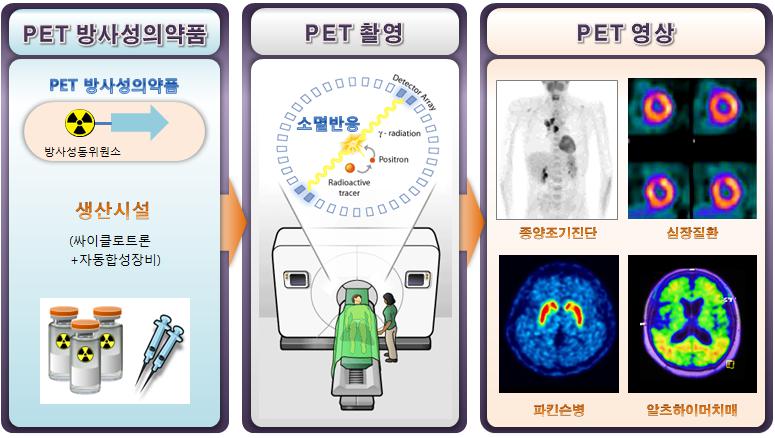 이미지: 진단용 PET 방사성의약품과 질환별 PET 영상