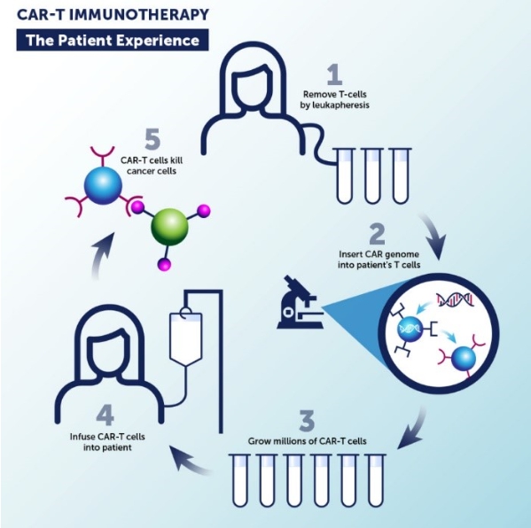 이미지: CAR-T cell 치료 과정 (자료: Sidney Kimmel Medical College)