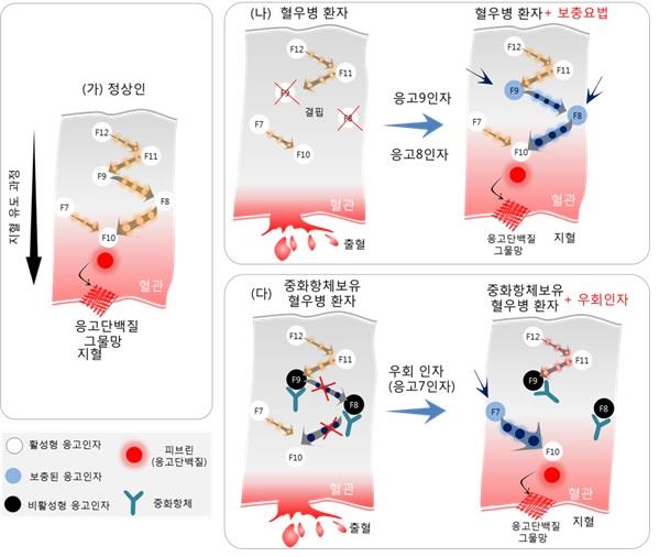 이미지: [혈우병 발병 기전]3