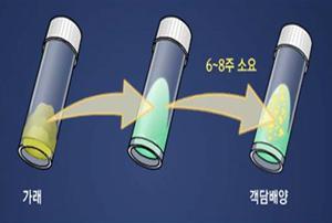 이미지: 배양검사