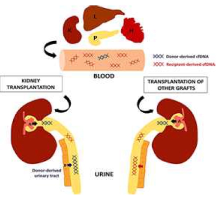 이미지: 장기 유래 cfdna