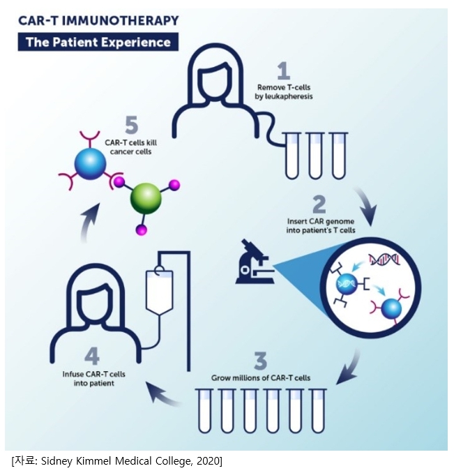 이미지: CAR-T cell 치료 과정