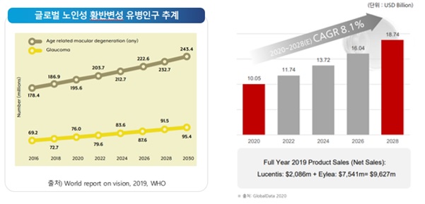 이미지: 글로벌 노인성 황반변성 유병인구 및 치료제 시장 전망
