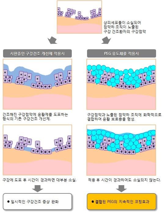 이미지: [그림] 구강건조증의 모식도