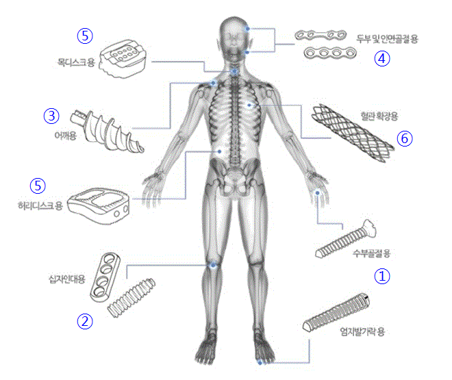 이미지: 생체흡수성 금속 임플란트 주요 상용화 대상품목