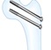 이미지: (Cannulated Screw)