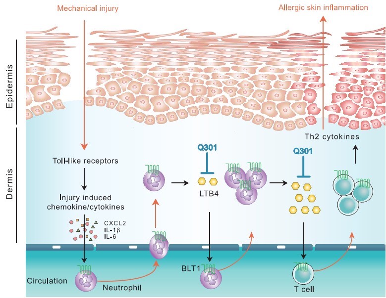 이미지: 아토피성 피부염 치료제 Q301의 기전