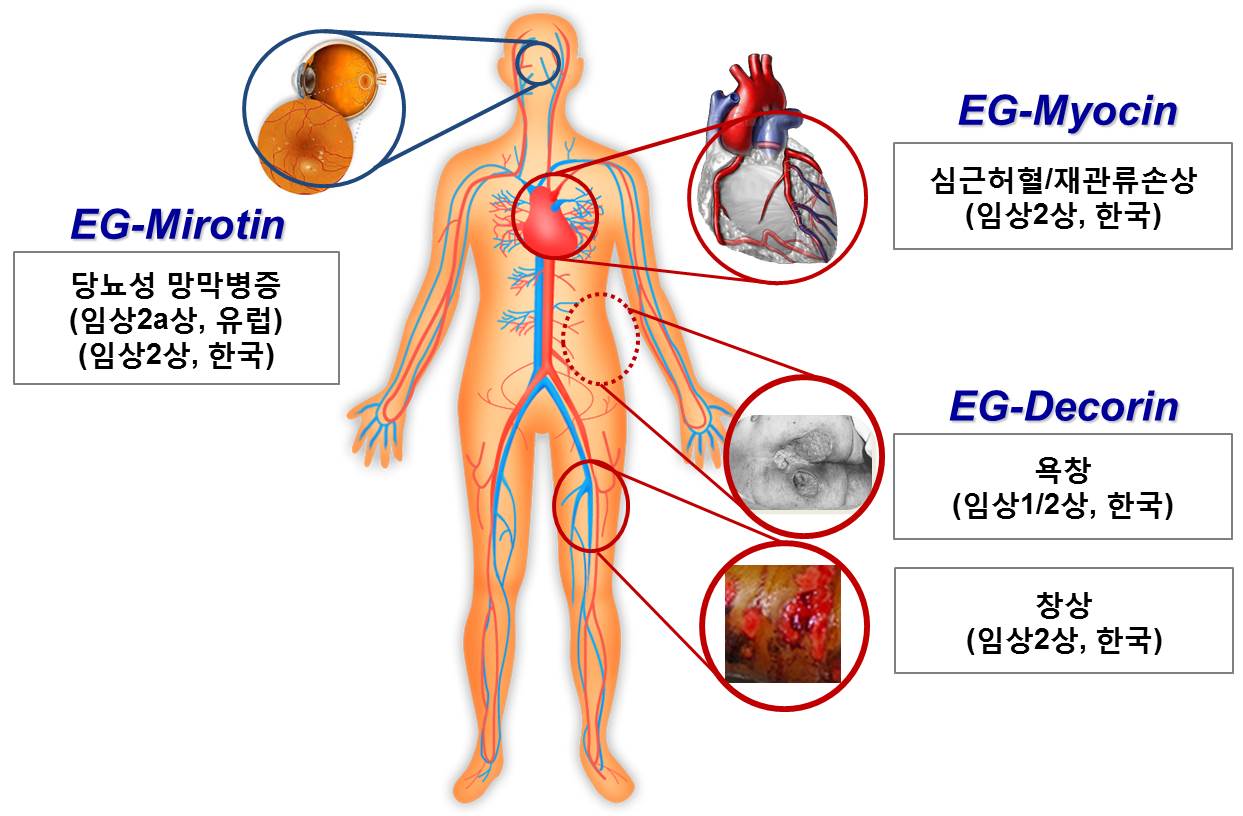 이미지: 허혈성 질환 치료제 대표 적용분야