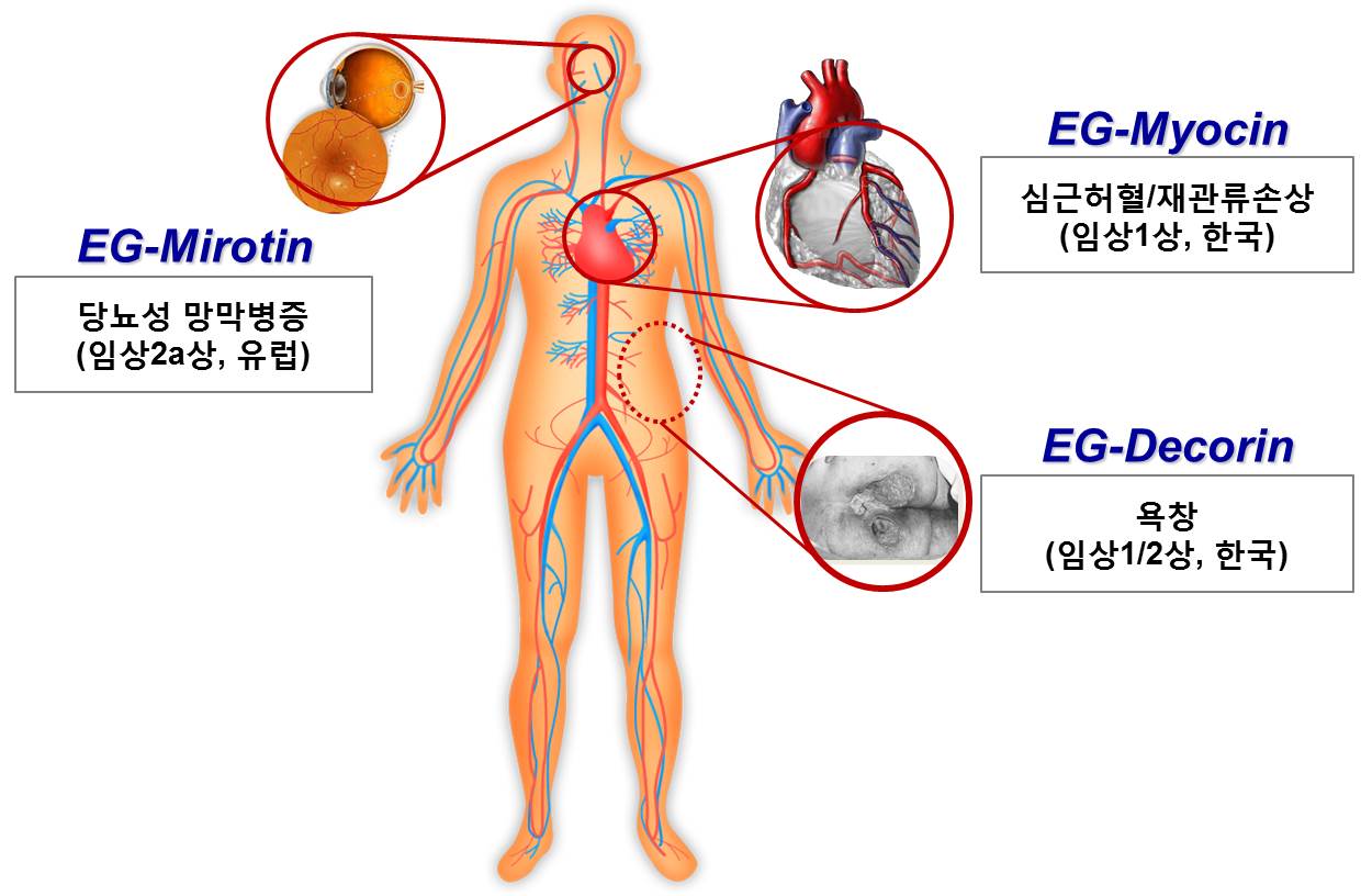 이미지: [ 허혈성 질환 치료제 대표 적용분야 ]