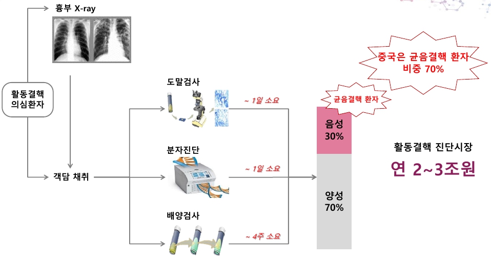 이미지: 객담검사와 균음결핵환자