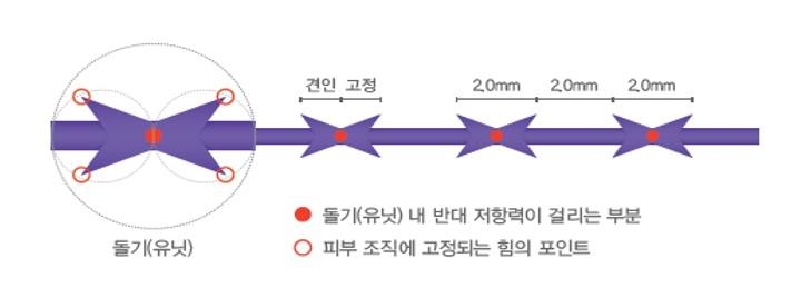 이미지: [에피티콘 리프팅실의 구조]