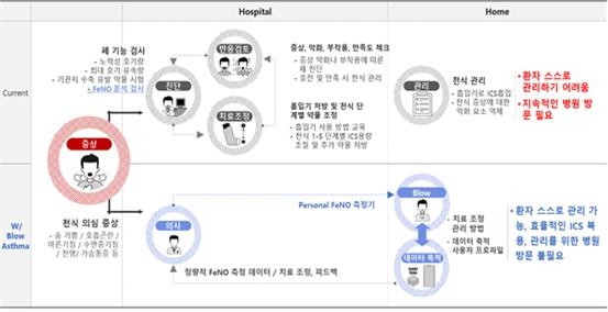 이미지: [기존 천식 진단, 관리 방법 대비 호기내 feno 측정기를 이용한 방법]