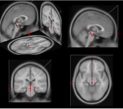 이미지: EEG