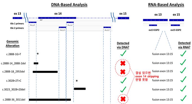 이미지: Exon14 skipping의 RNA 기반 분석의 중요성