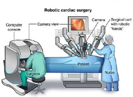 이미지: (자료) Johns Hopkins Medicine의Robotic Surgery 문서 중