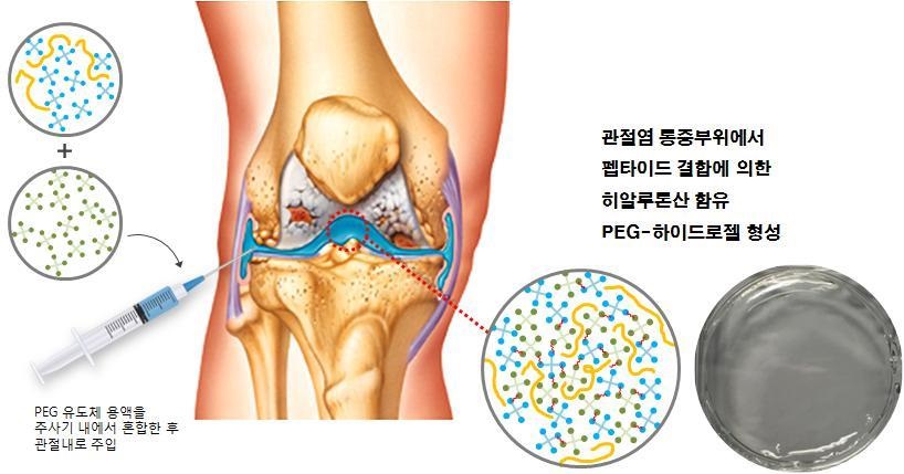 이미지: [SynoGel의 적용 모식도]