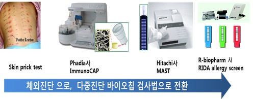 이미지: 알러지 진단 방식의 변화