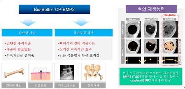 이미지: 골형성 촉진제 과정