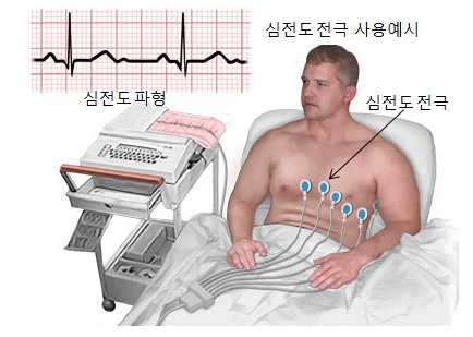 이미지: 심전도 전극 사용 예시