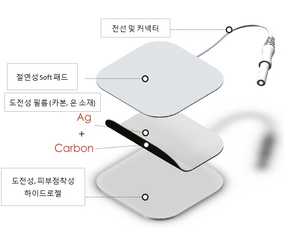 이미지: 저주파자극 전극 구성