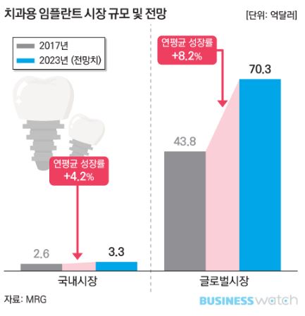 이미지: (치과용 임플란트 시장규모 및 전망)