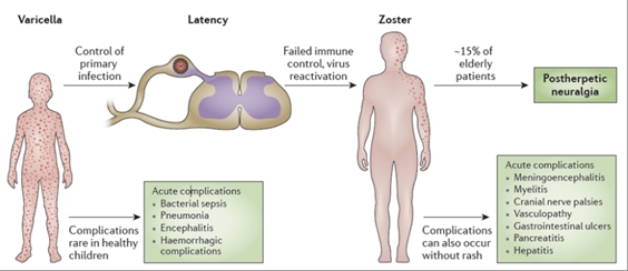 이미지: varicella zoster virus 감염의 여러 단계