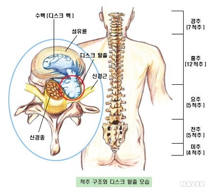 이미지: 사업의내용_척수및추간디스크