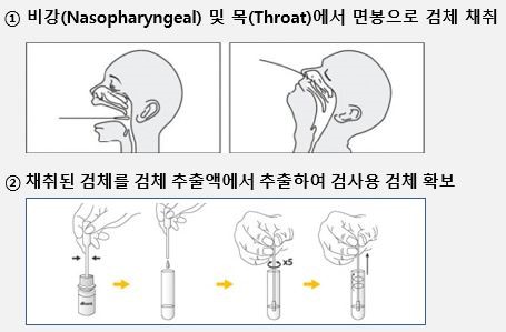 이미지: 임상용 검체의 채취 및 추출