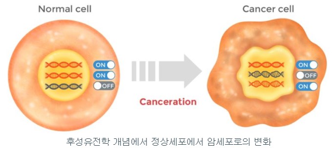 이미지: 후성유전학 개념에서 정상세포에서 암세포로의 변화