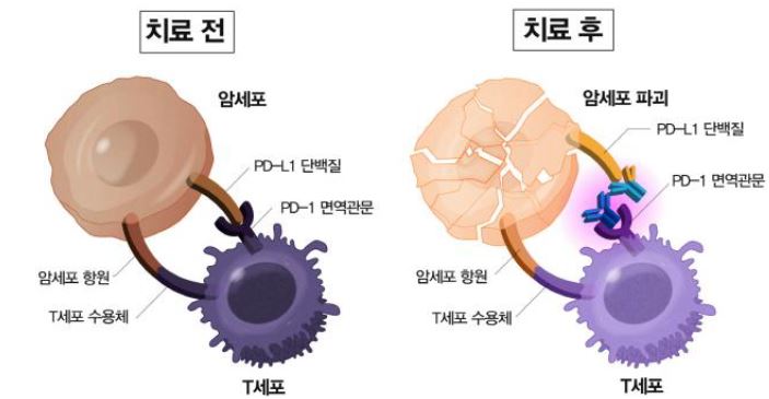 이미지: 면역관문억제제 개념도1