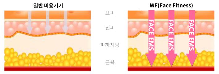 이미지: 일반미용기기