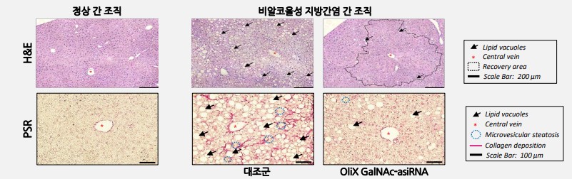 이미지: 그림. 비알코올성 지방간염 동물모델 효력 확인