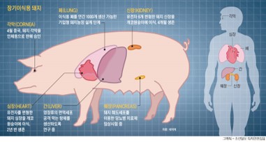 이미지: 사람에게 이식가능한 돼지 장기