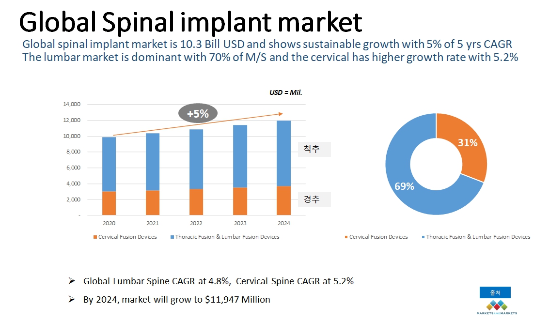 이미지: global spinal implant market