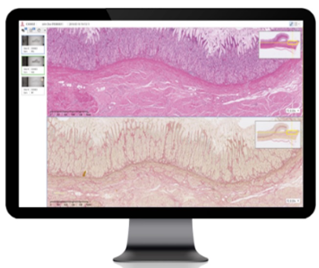 이미지: INFINITT Digital Pathology Solution