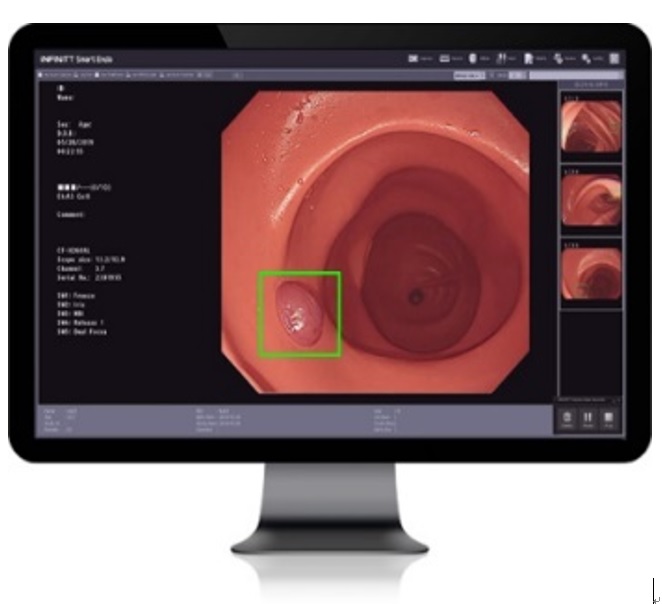 이미지: INFINITT Smart Endo