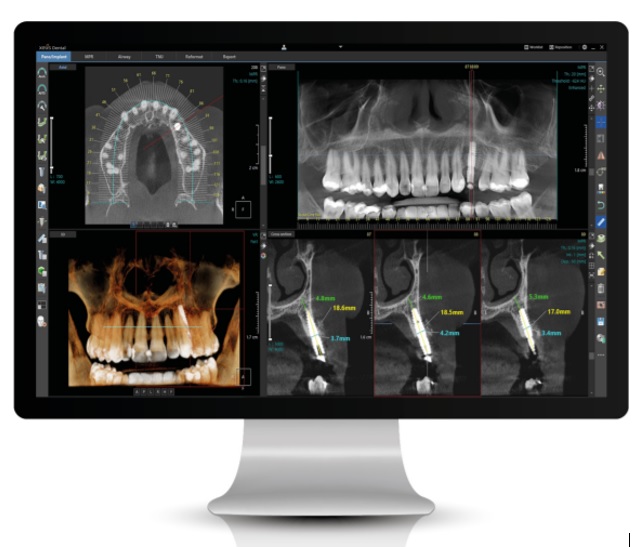 이미지: Xelis Dental 2.0