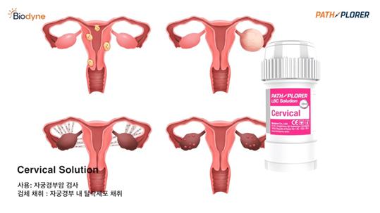 이미지: Cervical