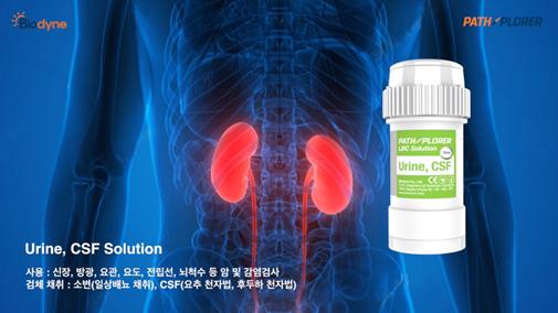 이미지: Urine, CSF
