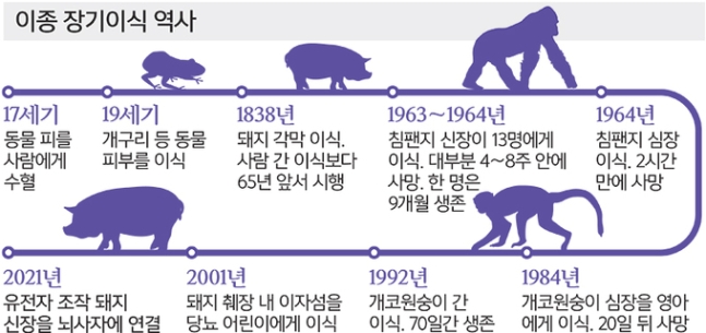 이미지: 이종장기 이식 역사