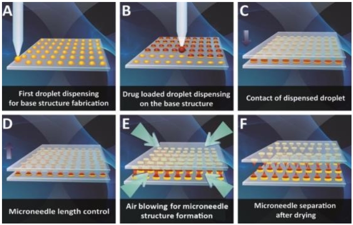 이미지: 적용기술을 사용한 마이크로니들 제조방법