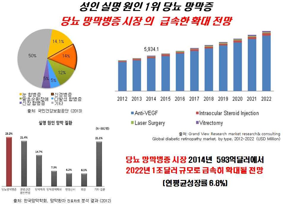 이미지: [당뇨성망막병증 치료제 시장 환경]